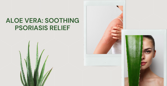 Relieve The Itching, Redness, and Scaling From Psoriasis With Aloe Vera Gel