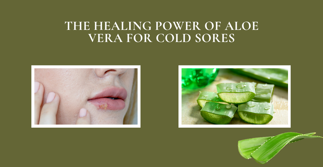 Ease The Pain Of Cold Sores and Shorten Duration With Aloe Vera